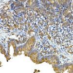 MDA5 Antibody in Immunohistochemistry (Paraffin) (IHC (P))