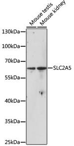 GLUT5 Antibody in Western Blot (WB)