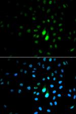 PIN1 Antibody in Immunocytochemistry (ICC/IF)