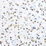 NR5A2 Antibody in Immunohistochemistry (Paraffin) (IHC (P))