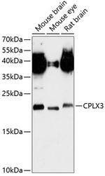 CPLX3 Antibody in Western Blot (WB)