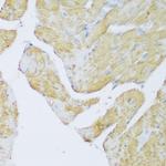 DENR Antibody in Immunohistochemistry (Paraffin) (IHC (P))