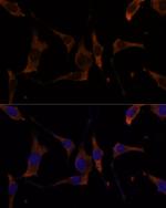 RPL7A Antibody in Immunocytochemistry (ICC/IF)