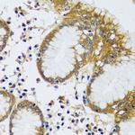 CAMLG Antibody in Immunohistochemistry (Paraffin) (IHC (P))