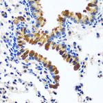 CAMLG Antibody in Immunohistochemistry (Paraffin) (IHC (P))