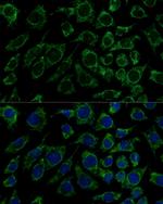 IDH3B Antibody in Immunocytochemistry (ICC/IF)