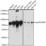 KARS Antibody in Western Blot (WB)