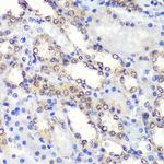 PSME4 Antibody in Immunohistochemistry (Paraffin) (IHC (P))