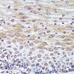 PSME4 Antibody in Immunohistochemistry (Paraffin) (IHC (P))