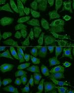 NDUFB4 Antibody in Immunocytochemistry (ICC/IF)