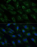 NDUFB4 Antibody in Immunocytochemistry (ICC/IF)