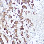 NDUFB4 Antibody in Immunohistochemistry (Paraffin) (IHC (P))