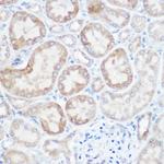 NDUFB4 Antibody in Immunohistochemistry (Paraffin) (IHC (P))