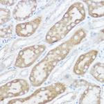 NDUFB4 Antibody in Immunohistochemistry (Paraffin) (IHC (P))