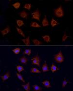 CPT1C Antibody in Immunocytochemistry (ICC/IF)