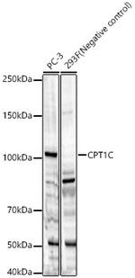 CPT1C Antibody in Western Blot (WB)