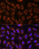 GANAB Antibody in Immunocytochemistry (ICC/IF)