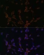 Dynein Antibody in Immunocytochemistry (ICC/IF)