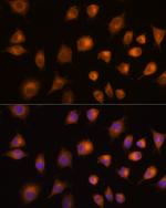 PKM2 Antibody in Immunocytochemistry (ICC/IF)