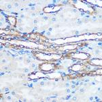 PKM2 Antibody in Immunohistochemistry (Paraffin) (IHC (P))