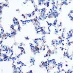 PKM2 Antibody in Immunohistochemistry (Paraffin) (IHC (P))