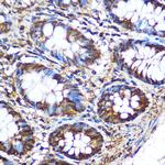 PKM2 Antibody in Immunohistochemistry (Paraffin) (IHC (P))