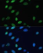 Emerin Antibody in Immunocytochemistry (ICC/IF)