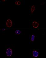 Emerin Antibody in Immunocytochemistry (ICC/IF)