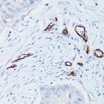 CD34 Antibody in Immunohistochemistry (Paraffin) (IHC (P))