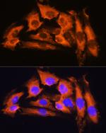 APRT Antibody in Immunocytochemistry (ICC/IF)