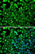 CDA Antibody in Immunocytochemistry (ICC/IF)