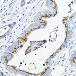 GALNT3 Antibody in Immunohistochemistry (Paraffin) (IHC (P))