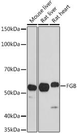 FIBB Antibody in Western Blot (WB)