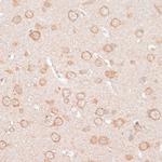 Kir2.3 (KCNJ4) Antibody in Immunohistochemistry (Paraffin) (IHC (P))