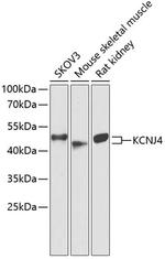 Kir2.3 (KCNJ4) Antibody in Western Blot (WB)