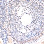 SMAD5 Antibody in Immunohistochemistry (Paraffin) (IHC (P))