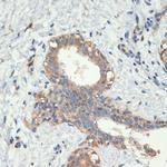 SMAD5 Antibody in Immunohistochemistry (Paraffin) (IHC (P))