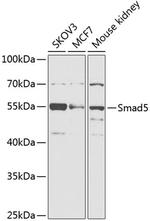 SMAD5 Antibody in Western Blot (WB)