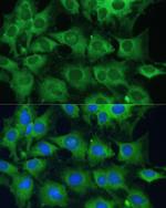 PTPN22 Antibody in Immunocytochemistry (ICC/IF)