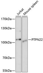 PTPN22 Antibody in Western Blot (WB)