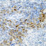 SULT2A1 Antibody in Immunohistochemistry (Paraffin) (IHC (P))