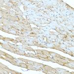 Dystrophin Antibody in Immunohistochemistry (Paraffin) (IHC (P))