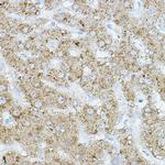 HRI Antibody in Immunohistochemistry (Paraffin) (IHC (P))