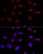 NOP58 Antibody in Immunocytochemistry (ICC/IF)