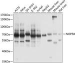 NOP58 Antibody in Western Blot (WB)