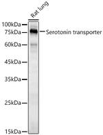 SLC6A4 Antibody in Western Blot (WB)