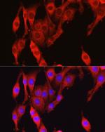 Vinculin Antibody in Immunocytochemistry (ICC/IF)