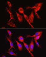 Vinculin Antibody in Immunocytochemistry (ICC/IF)