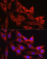 Vinculin Antibody in Immunocytochemistry (ICC/IF)