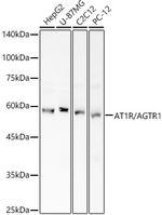 AGTR1 Antibody in Western Blot (WB)